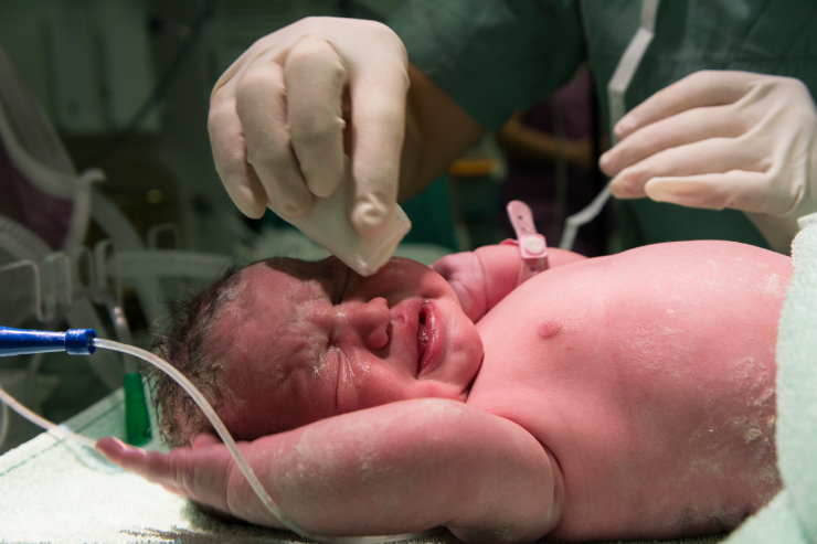 Newborn Care and Neonatal Resuscitation